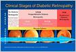 The Four Stages of Diabetic Retinopathy